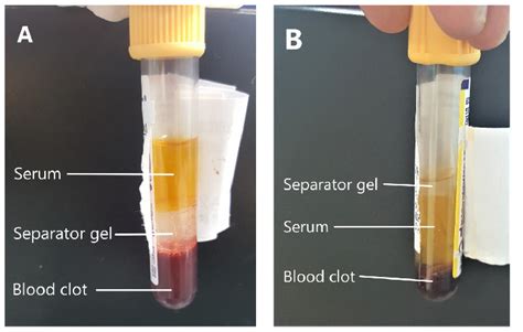 Blood Sample Avoidance: