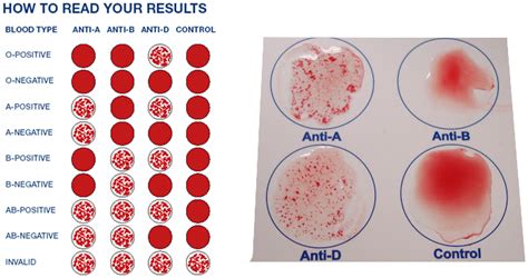Blood Type Testing Chart