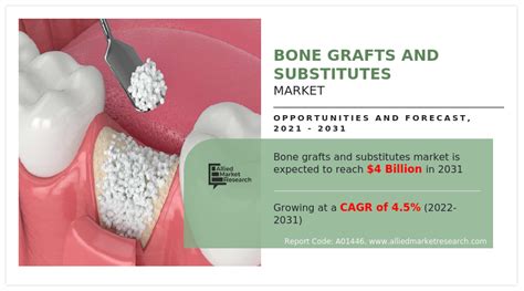 Bone Grafts and Bone Substitutes Doc