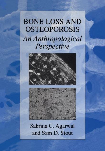 Bone Loss and Osteoporosis An Anthropological Perspective 1st Edition PDF