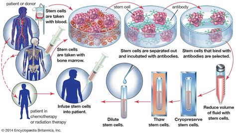 Bone Marrow Transplantation Doc