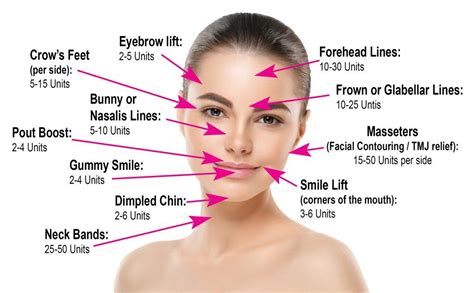 Botox Face Chart