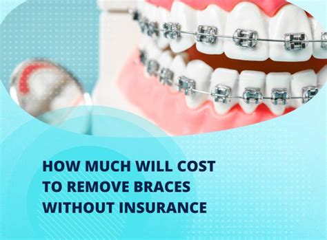 Braces Cost Without Insurance: A Comprehensive Guide for Every Budget