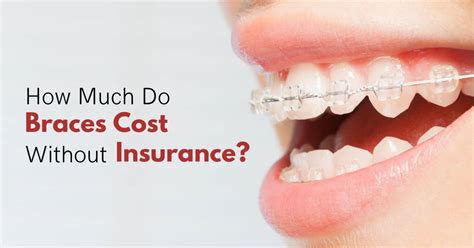 Braces Cost with Insurance: All You Need to Know