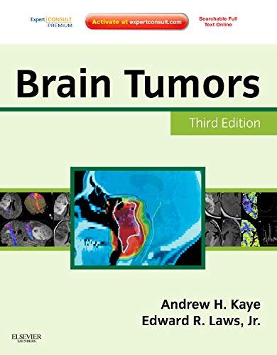 Brain Tumors An Encyclopedic Approach Doc