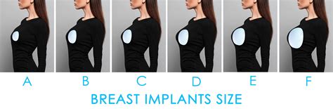 Breast Augmentation PDF