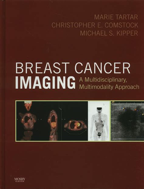 Breast Cancer Imaging A Multidisciplinary Kindle Editon