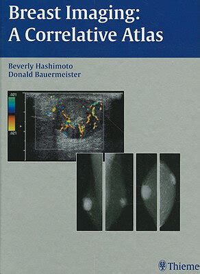 Breast Imaging A Correlative Atlas 1st Edition Kindle Editon