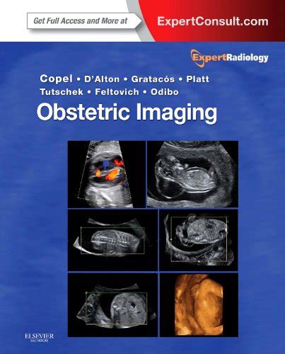 Breast Imaging Expert Radiology series Expert Consult- Online and Print Epub