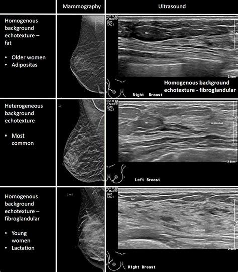 Breast Ultrasound Kindle Editon