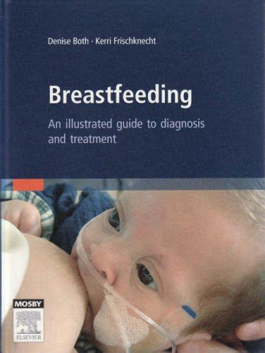 Breastfeeding An Illustrated Guide to Diagnosis and Treatment Kindle Editon