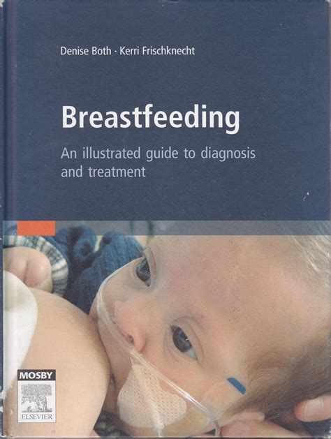 Breastfeeding An Illustrated Guide to Diagnosis and Treatment Kindle Editon