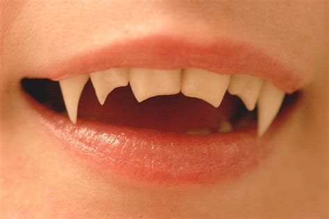 Buffy the Vampire Slayer Teeth: The Ultimate Guide