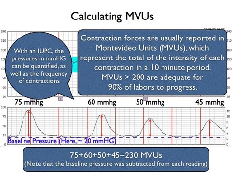 Calculating MVUs