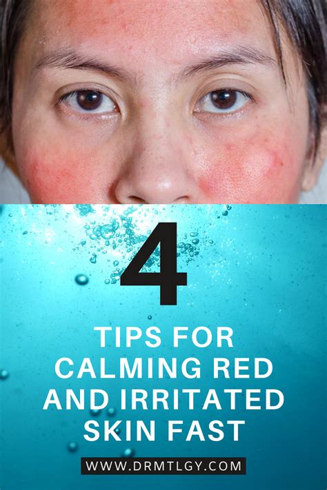 Calms redness and irritation: