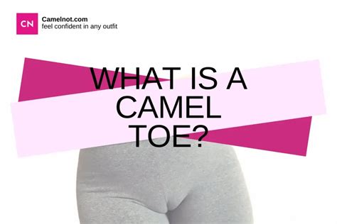 Camel Toes: What They Are and Why They're a Problem