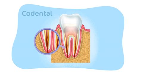 Canal No Dente: Um Guia Completo para Entender e Tratar o Problema