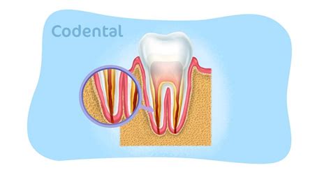 Canal no Dente: Entenda Tudo Sobre o Tratamento e os Custos