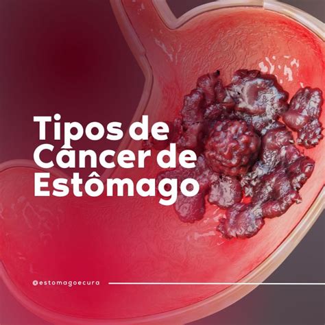 Cancer 777: Uma Visão Abrangente para Superar o Câncer