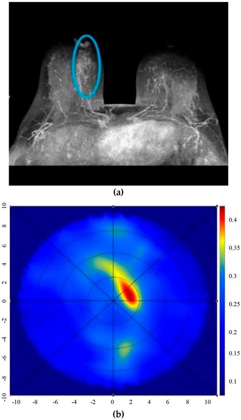 Cancer Detection and Imaging: