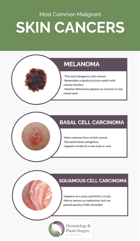 Cancer Red Spots on Skin: A Comprehensive Guide