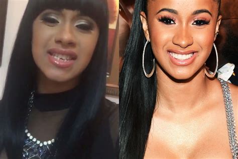 Cardi B Before Plastic Surgery: An Illustrated Timeline