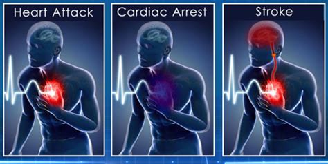 Cardiovascular Assault: