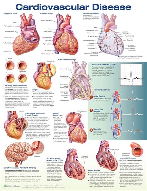 Cardiovascular Disease Chart