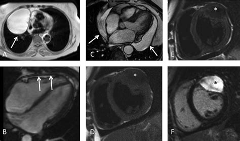 Cardiovascular Magnetic Resonance Epub