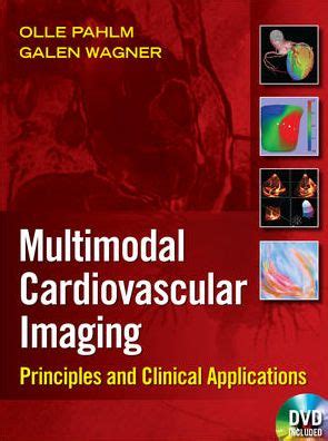 Cardiovascular Multimodal Image-Guided Diagnosis and Therapy 1st Edition Kindle Editon