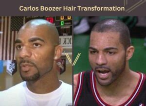 Carlos Boozer Hairline: A Comprehensive Analysis