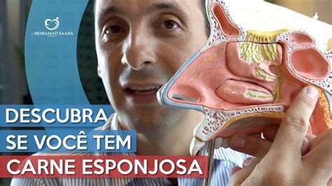 Carne esponjosa no nariz: entenda o que é e como tratar