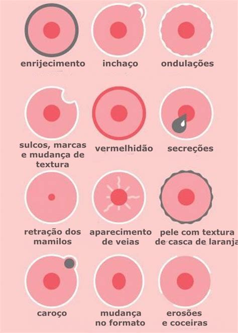 Caroço na Axila: Um Sinal de Alerta para Câncer de Mama