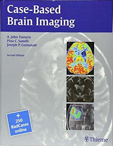 Case-Based Brain Imaging 2nd Edition Doc