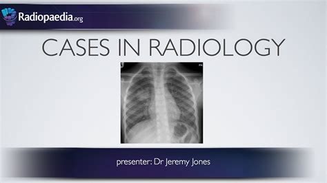 Cases in Pediatric Radiology Reader