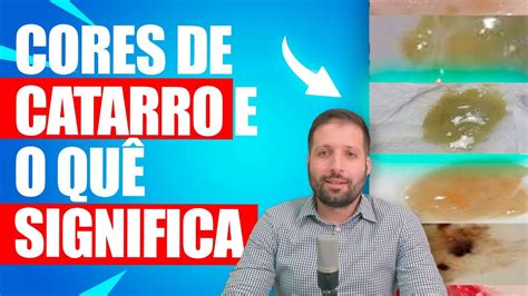 Catarros Verde: O que Significam e Como Tratá-los