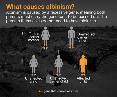 Causes of Albinism: