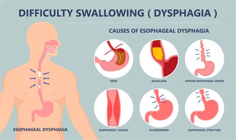 Causes of Dysphagia