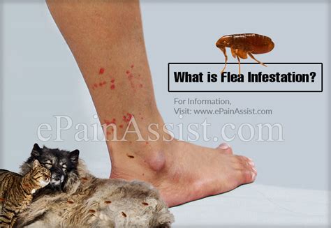 Causes of Flea Infestation in Humans