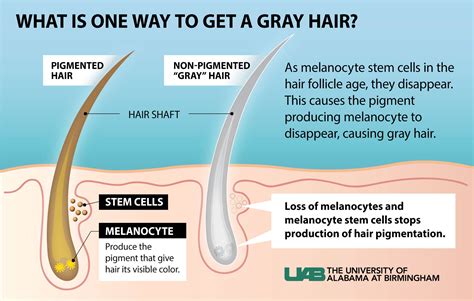 Causes of Gray Hair