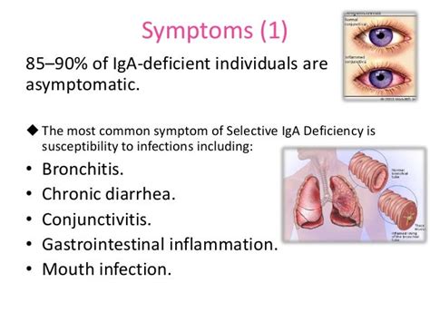 Causes of IgA Deficiency