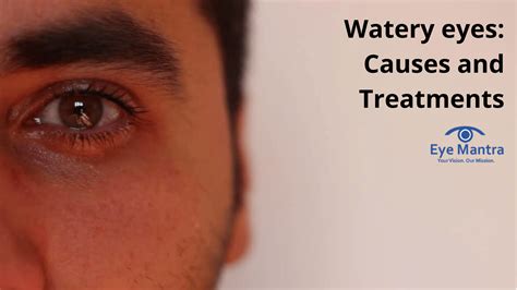 Causes of Incessant Watering Eyes