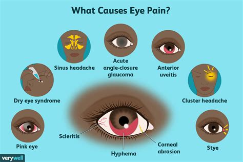 Causes of Pain in Corner of Eye