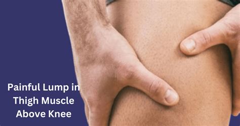 Causes of Painful Lumps in Thigh Muscle: A Detailed Exploration