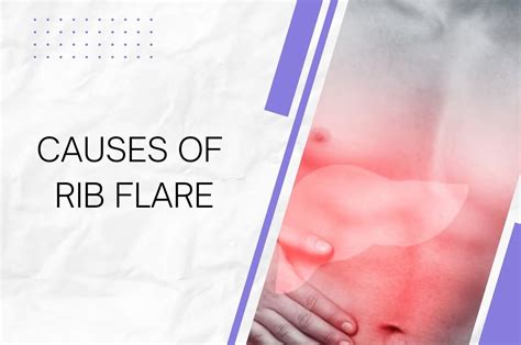 Causes of Rib Flare in Women