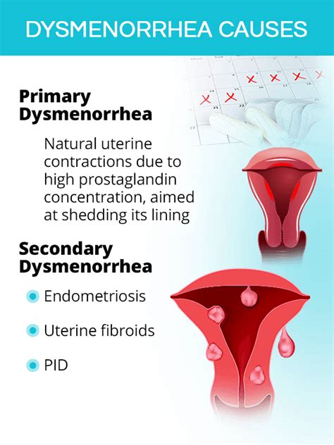 Causes of Sloan's Moans (Dysmenorrhea)