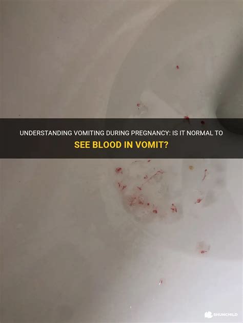 Causes of Small Amounts of Blood in Vomit During Pregnancy