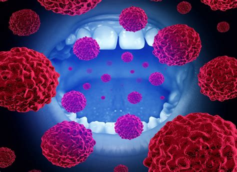 Cautionary Insights: Unveiling the Link Between Zyns and Oral Cancer