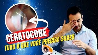 Ceratocone: Tudo o Que Você Precisa Saber