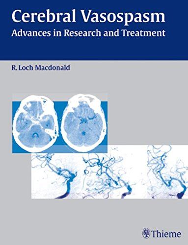 Cerebral Vasospasm Advances in Research and Treatment Doc